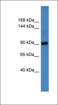 Anti-HPS3 antibody produced in rabbit affinity isolated antibody