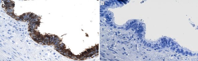 Anti-Mesothelin Antibody, clone 1I3 ZooMAb&#174; Rabbit Monoclonal recombinant, expressed in HEK 293 cells