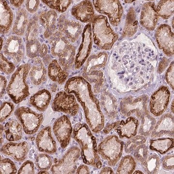 Anti-CTC-534A2.2 antibody produced in rabbit Prestige Antibodies&#174; Powered by Atlas Antibodies, affinity isolated antibody, buffered aqueous glycerol solution