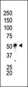 ANTI-AMPK ALPHA 1(C-TERMINAL) antibody produced in rabbit IgG fraction of antiserum, buffered aqueous solution