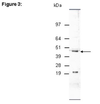 ChIPAb+ JMJD1C - durch ChIP validiertes Antikörper- und Primer-Set from rabbit, purified by affinity chromatography