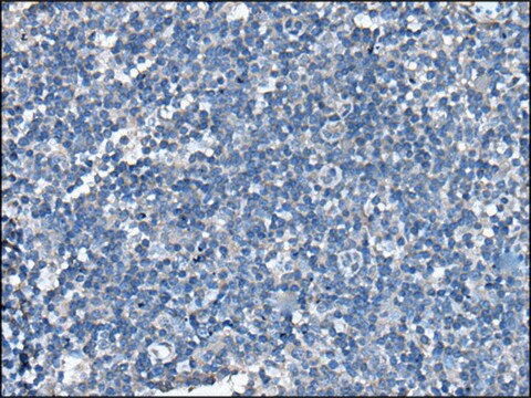 Anti-UFC1 affinity isolated antibody