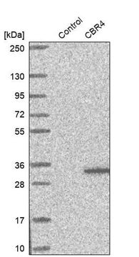 Anti-CBR4 antibody produced in rabbit Prestige Antibodies&#174; Powered by Atlas Antibodies, affinity isolated antibody, buffered aqueous glycerol solution