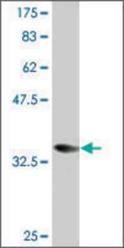 Monoclonal Anti-CORO1A, (C-terminal) antibody produced in mouse clone 1A8, purified immunoglobulin, buffered aqueous solution