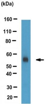 Anticorpo anti-ACAT-2 from rabbit, purified by affinity chromatography