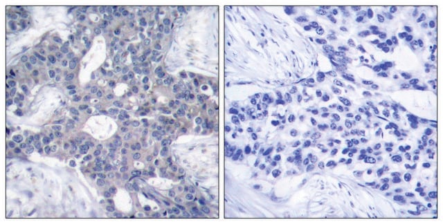 Anti-ZAP-70, antibody produced in rabbit affinity isolated antibody