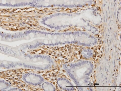 Monoclonal Anti-TRIM16 antibody produced in mouse clone 5G11, purified immunoglobulin, buffered aqueous solution