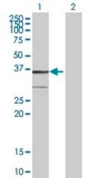 Anti-BDH1 antibody produced in mouse purified immunoglobulin, buffered aqueous solution