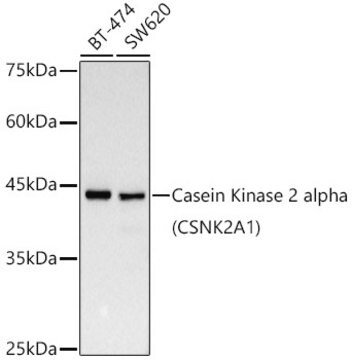 Anti-[KD Validated] Casein Kinase 2 alpha (CSNK2A1) Antibody, clone 2P3M7, Rabbit Monoclonal