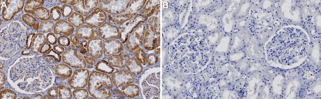 Anticorps anti-complexe I-75kD from rabbit, purified by affinity chromatography