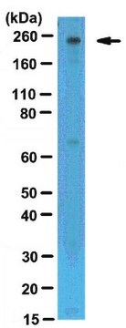 Anti-Mi-2b (CHD4) Antibody serum, from rabbit