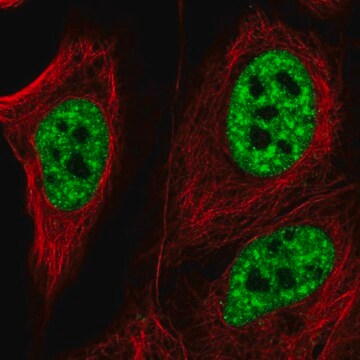 Anti-ZNF621 antibody produced in rabbit Prestige Antibodies&#174; Powered by Atlas Antibodies, affinity isolated antibody