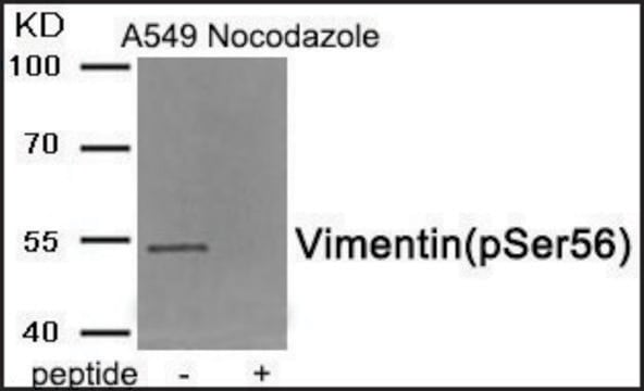 Anti-phospho-Vimentin (pSer56) antibody produced in rabbit affinity isolated antibody