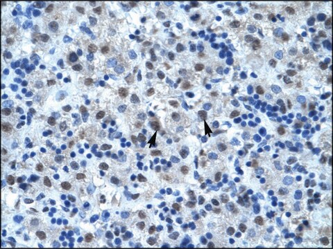 Anti-CDC25B (AB2) antibody produced in rabbit affinity isolated antibody