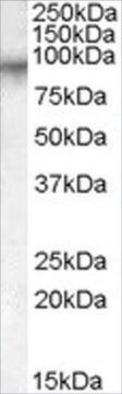 Anti-Factor XIIIA (703-717) antibody produced in goat affinity isolated antibody, buffered aqueous solution