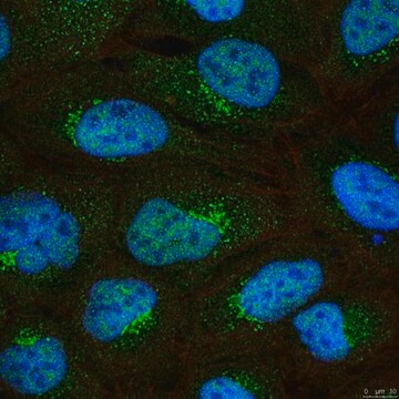 Anti-SETD5 from rabbit, purified by affinity chromatography