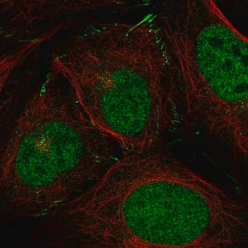 Anti-Znf469 Antibody Produced In Rabbit Prestige Antibodies&#174; Powered by Atlas Antibodies, affinity isolated antibody, buffered aqueous glycerol solution