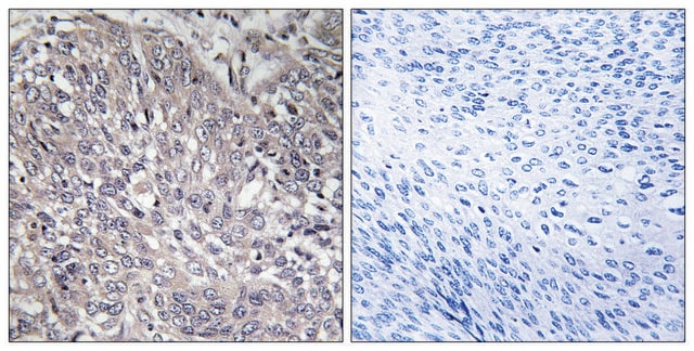 Anti-INSP3R1 antibody produced in rabbit affinity isolated antibody