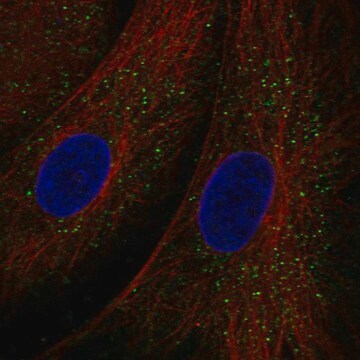 Anti-Tex36 Antibody Produced In Rabbit Prestige Antibodies&#174; Powered by Atlas Antibodies, affinity isolated antibody, buffered aqueous glycerol solution