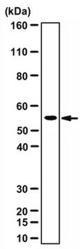 Anti-Alpha-ketoglutarate-dependent dioxygenase FTO Antibody from rabbit, purified by affinity chromatography