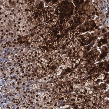 Anti-MBD6 antibody produced in rabbit Prestige Antibodies&#174; Powered by Atlas Antibodies, affinity isolated antibody, buffered aqueous glycerol solution