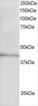 Anti-ARH/LDL Receptor Adaptor antibody produced in goat affinity isolated antibody, buffered aqueous solution