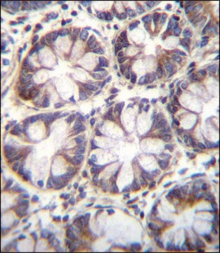 ANTI-SLC36A1 (N-TERM) antibody produced in rabbit IgG fraction of antiserum, buffered aqueous solution