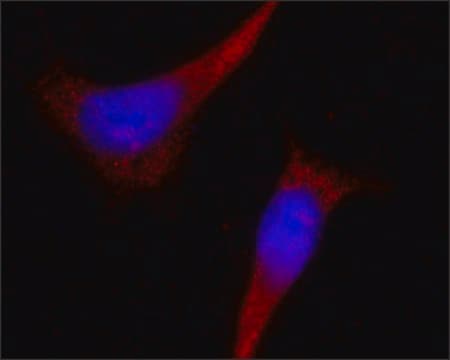 Monoclonal Anti-WDR49 antibody produced in mouse ~1.0&#160;mg/mL, clone W49.1, purified immunoglobulin