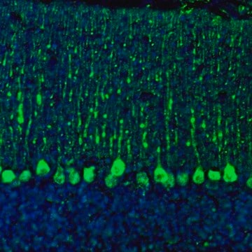 Anti-C21orf59 antibody produced in rabbit Prestige Antibodies&#174; Powered by Atlas Antibodies, affinity isolated antibody, buffered aqueous glycerol solution