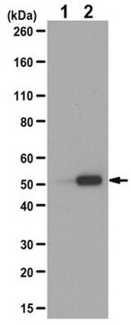 Anti-acetyl Tubulin (Lys40) Antibody from rabbit, purified by affinity chromatography