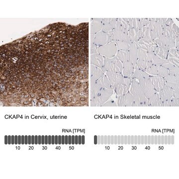 Anti-CKAP4 antibody produced in rabbit Ab1, Prestige Antibodies&#174; Powered by Atlas Antibodies, affinity isolated antibody, buffered aqueous glycerol solution