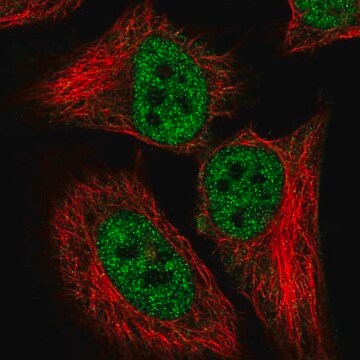 Anti-CDKN2AIP antibody produced in rabbit Prestige Antibodies&#174; Powered by Atlas Antibodies, affinity isolated antibody