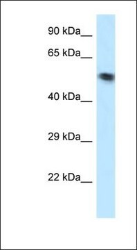 Anti-VPS4B antibody produced in rabbit affinity isolated antibody