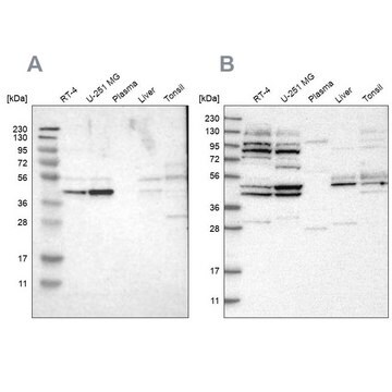 Anti-WDR53 antibody produced in rabbit Prestige Antibodies&#174; Powered by Atlas Antibodies, affinity isolated antibody, buffered aqueous glycerol solution