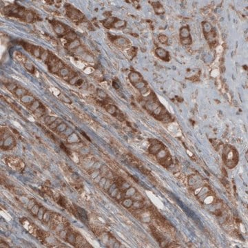 Monoclonal Anti-CARS antibody produced in mouse Prestige Antibodies&#174; Powered by Atlas Antibodies, clone CL2302, purified immunoglobulin, buffered aqueous glycerol solution