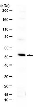 Anti-WTAP Antibody from rabbit, purified by affinity chromatography