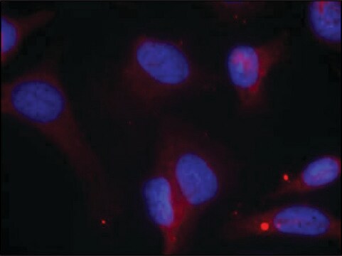 Anti-phospho-ZAP70 (pTyr319) antibody produced in rabbit affinity isolated antibody