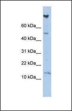 Anti-NRARP antibody produced in rabbit affinity isolated antibody