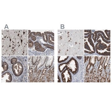 Anti-USP10 antibody produced in rabbit Ab1, Prestige Antibodies&#174; Powered by Atlas Antibodies, affinity isolated antibody, buffered aqueous glycerol solution