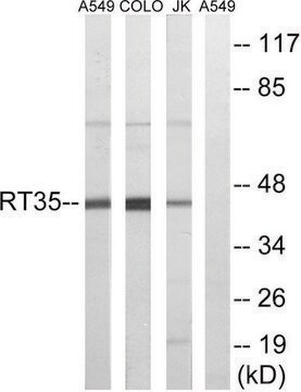 Anti-MRPS35 antibody produced in rabbit affinity isolated antibody