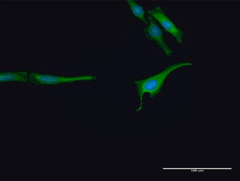 Anti-RNF14 antibody produced in rabbit purified immunoglobulin, buffered aqueous solution