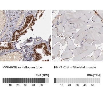 Anti-PPP4R3B antibody produced in rabbit Prestige Antibodies&#174; Powered by Atlas Antibodies, affinity isolated antibody, buffered aqueous glycerol solution