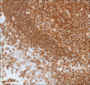 Anti-CD19 antibody, Rabbit monoclonal clone SP110, recombinant, expressed in proprietary host, affinity isolated antibody