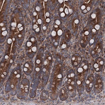 Anti-RUFY1 antibody produced in rabbit Prestige Antibodies&#174; Powered by Atlas Antibodies, affinity isolated antibody, buffered aqueous glycerol solution