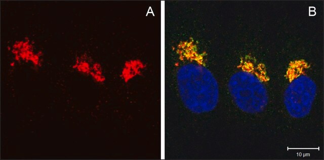 Anti-COG8 (C-terminal) antibody produced in rabbit ~1.0&#160;mg/mL, affinity isolated antibody