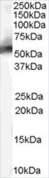 Anti-MDM2 (Isoform) antibody produced in goat affinity isolated antibody, buffered aqueous solution