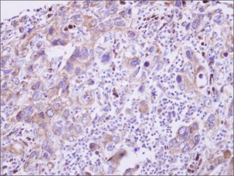 Anti-GDF5 (C-terminal) antibody produced in rabbit affinity isolated antibody, buffered aqueous solution