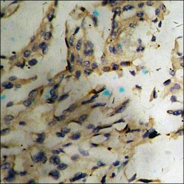 Anti-phospho-NFAT4 (pSer165) antibody produced in rabbit affinity isolated antibody