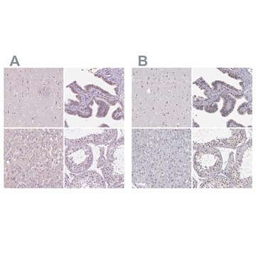 Anti-NHP2 antibody produced in rabbit Prestige Antibodies&#174; Powered by Atlas Antibodies, affinity isolated antibody, buffered aqueous glycerol solution