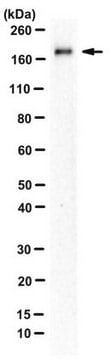 Anti-Slit2 Antibody, C-term from rabbit, purified by affinity chromatography